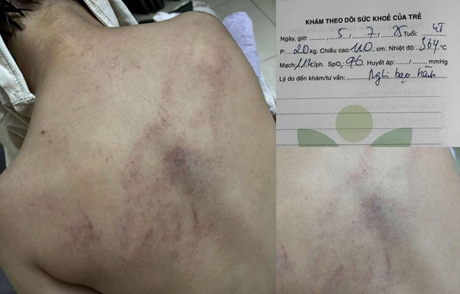 "Giáo viên hay kẻ ác nhân mà đánh trẻ không biết ghê tay"- Ảnh 2.