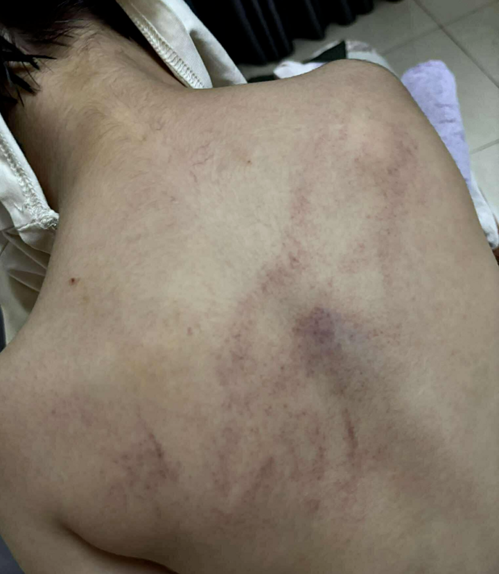 "Giáo viên hay kẻ ác nhân mà đánh trẻ không biết ghê tay"- Ảnh 1.