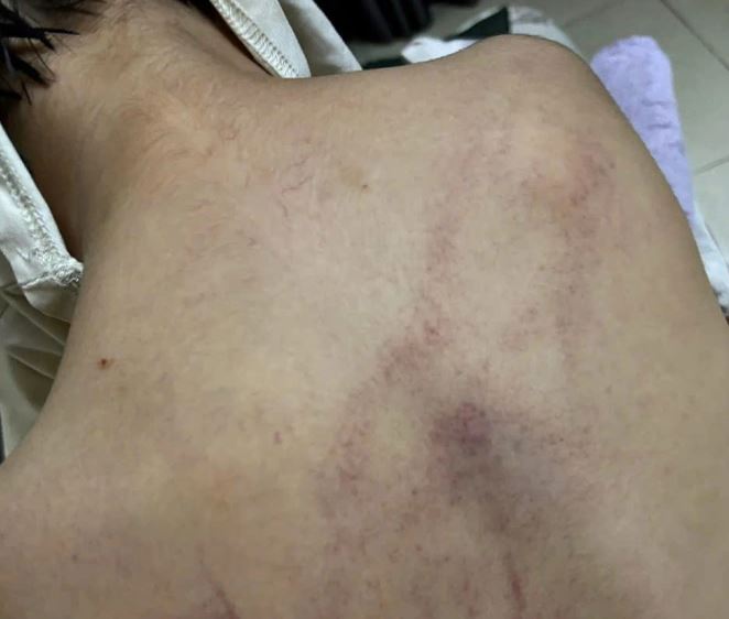 Đọc vụ bạo hành mới đây, tôi càng quyết tâm chọn trường có camera: Bảo vệ trẻ em quan trọng hơn sự riêng tư của người lớn!- Ảnh 1. Đọc vụ bạo hành mới đây, tôi càng quyết tâm chọn trường có camera: Bảo vệ trẻ em quan trọng hơn sự riêng tư của người lớn!- Ảnh 1.