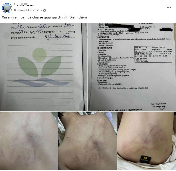 Bé gái mầm non nghi bị bạo hành, đánh tím lưng tại Hà Nội: Gia đình bàng hoàng khi biết lý do- Ảnh 1. Bé gái mầm non nghi bị bạo hành, đánh tím lưng tại Hà Nội: Gia đình bàng hoàng khi biết lý do- Ảnh 1.