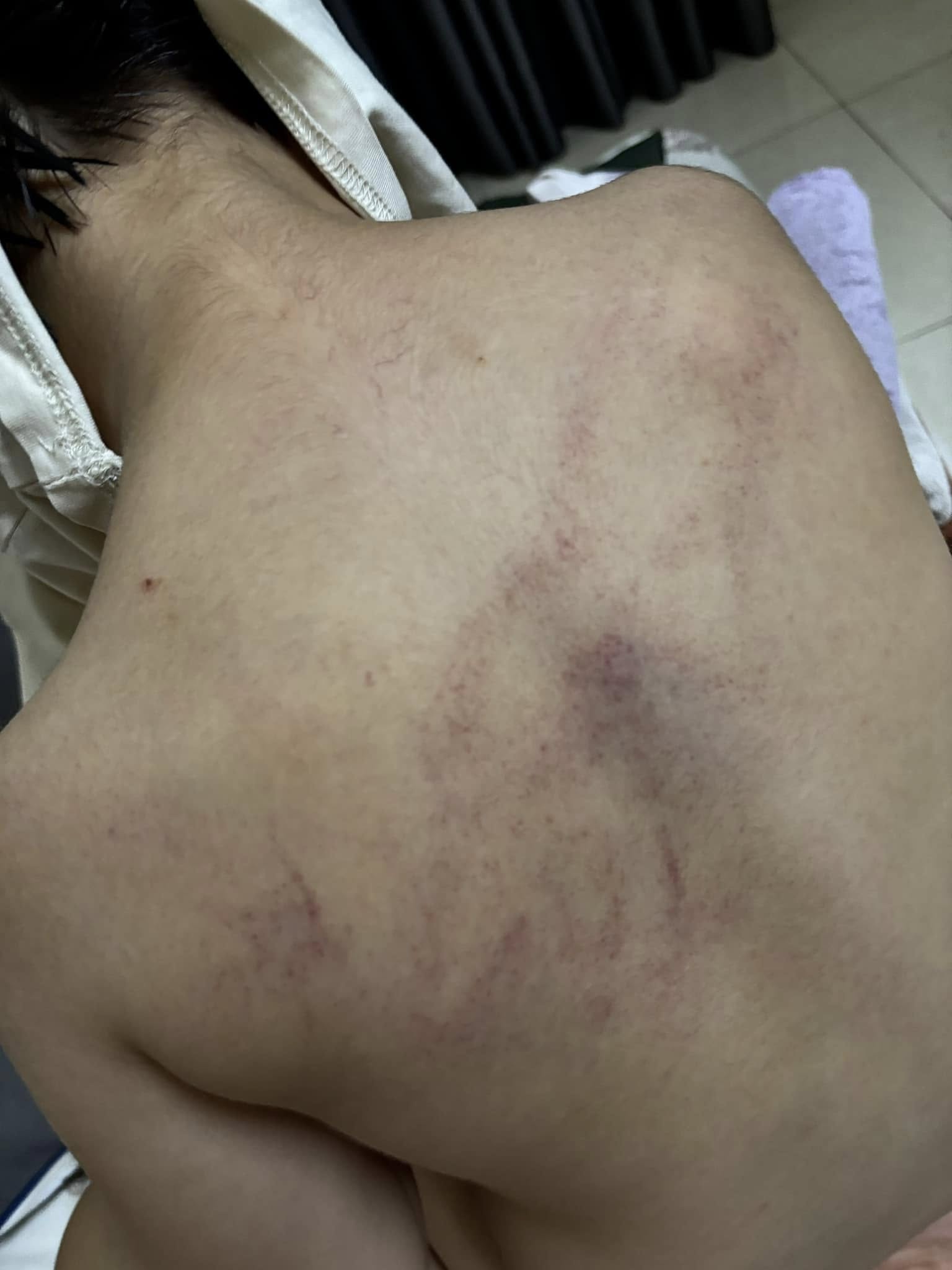 Vụ bé 4 tuổi bị giáo viên đánh, ném vào tường ở Hà Nội: Người mẹ tiết lộ câu nói gây sốc- Ảnh 1.