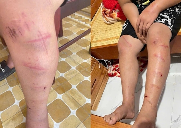 Làm rõ việc nam sinh ở Huế bị người đàn ông xích chân, hành hung- Ảnh 2.