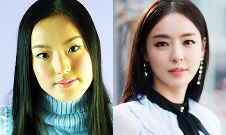 Showbiz kiếm đâu ra người thứ 2 dao kéo đỉnh cỡ này, visual hoàn mỹ đến từng lỗ chân lông- Ảnh 2.