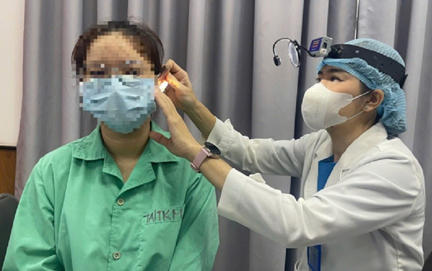 Bị vỡ xương thái dương, suýt điếc vĩnh viễn vì… ngoáy tai- Ảnh 2.