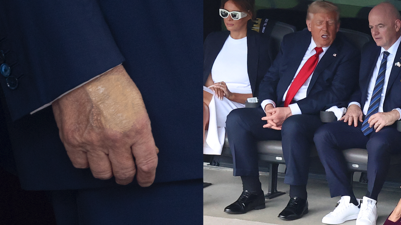 Nhà Trắng thông báo Tổng thống Donald Trump mắc suy tĩnh mạch mạn tính- Ảnh 1.