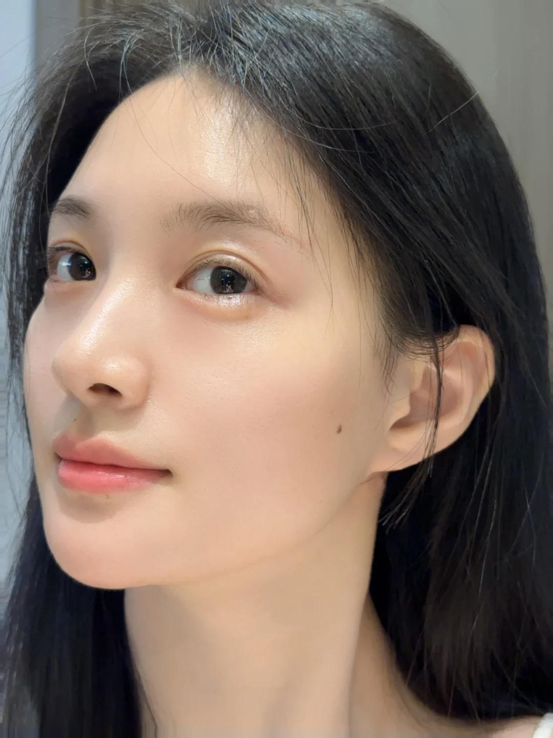 Phẫu thuật hàm mặt: Giải pháp chỉnh hình toàn diện từ cấu trúc xương- Ảnh 2.