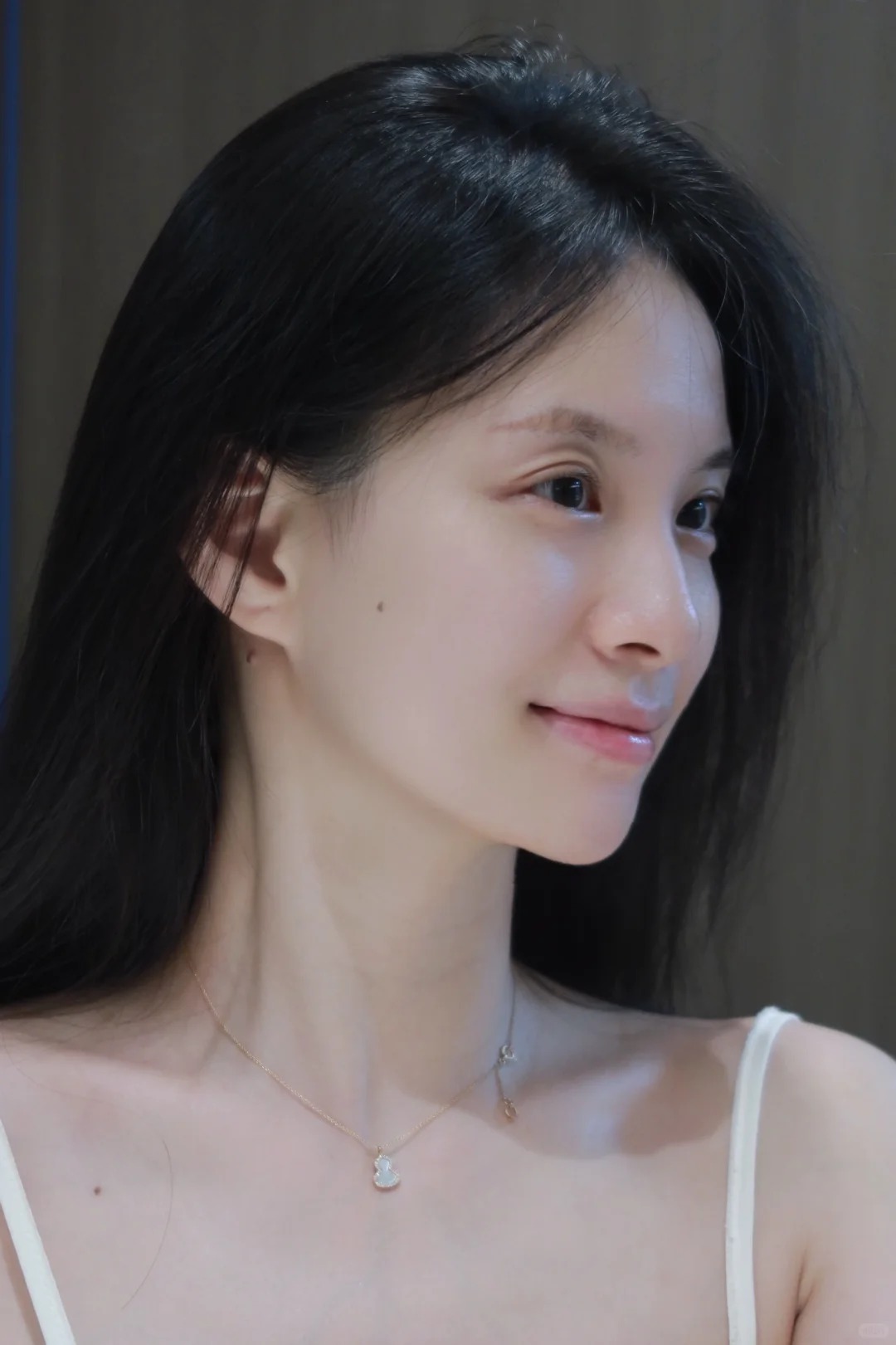 Phẫu thuật hàm mặt: Giải pháp chỉnh hình toàn diện từ cấu trúc xương- Ảnh 7.