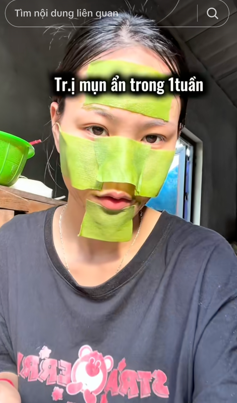 Trị mụn ẩn, thâm mụn trong 1 tuần, cô nàng dùng chiêu đơn giản đến không ngờ- Ảnh 9.