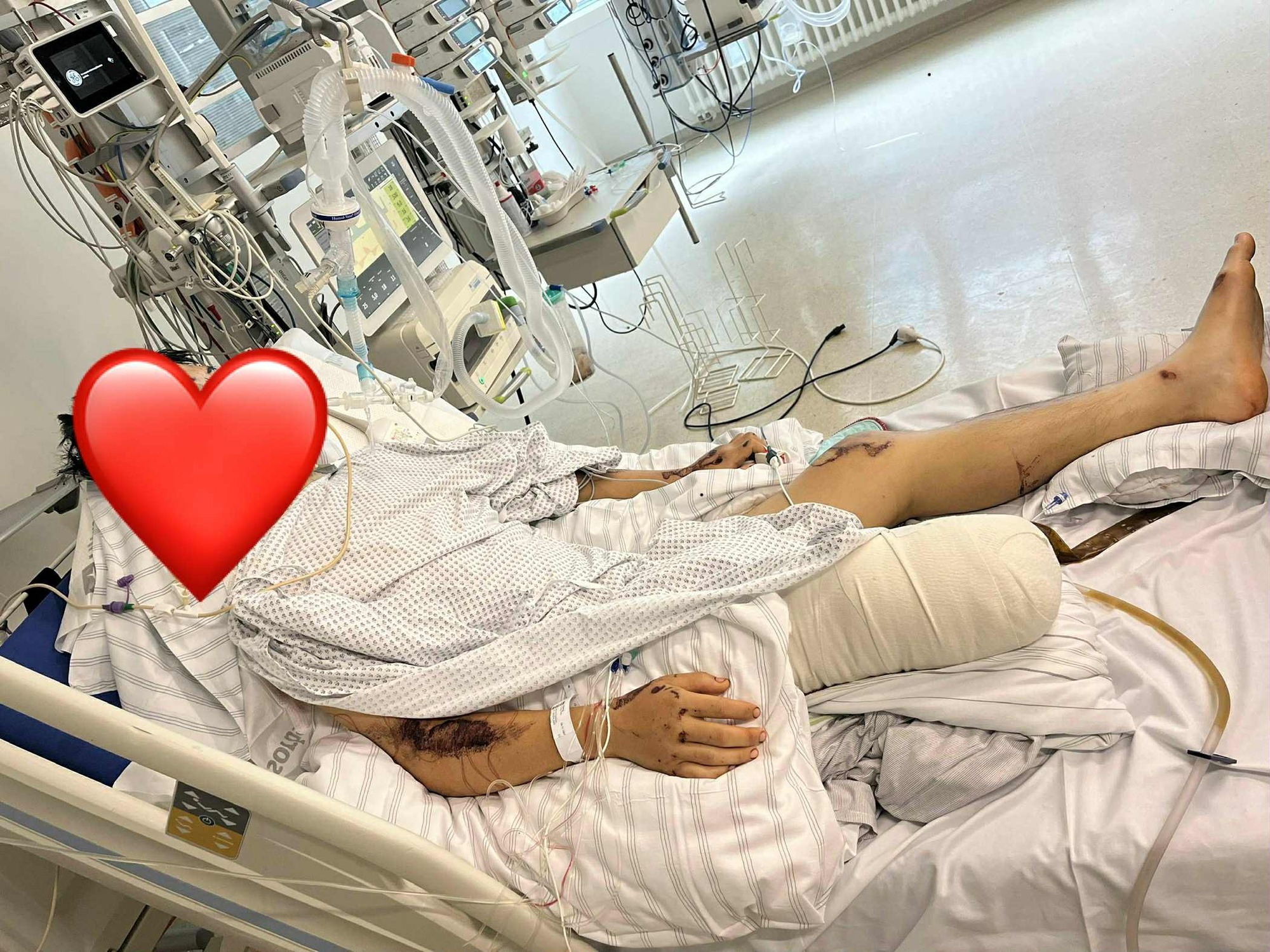 2 du học sinh Việt tử vong, 1 nam sinh nguy kịch sau tai nạn nghiêm trọng ở Đức - người yêu khẩn cầu trợ giúp- Ảnh 2.