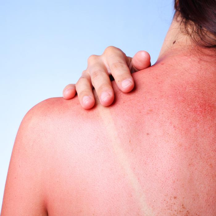 Kem chống nắng Topicrem Sun Protect lá chắn tuyệt vời – cùng gia đình đón nắng an toàn- Ảnh 2.