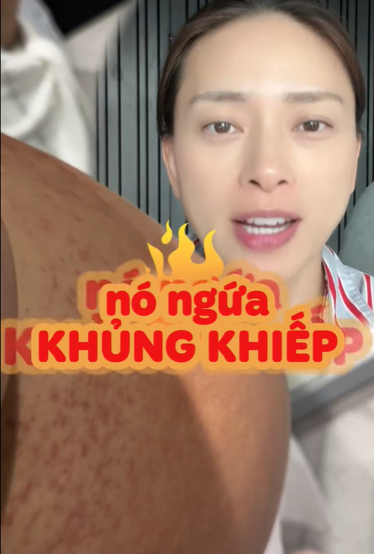 Mẹ bầu Ngô Thanh Vân gặp một tình trạng "vô cùng khó chịu" trong thai kỳ: Ngứa khủng khiếp nhưng vẫn thấy mừng vì 1 điều- Ảnh 2.