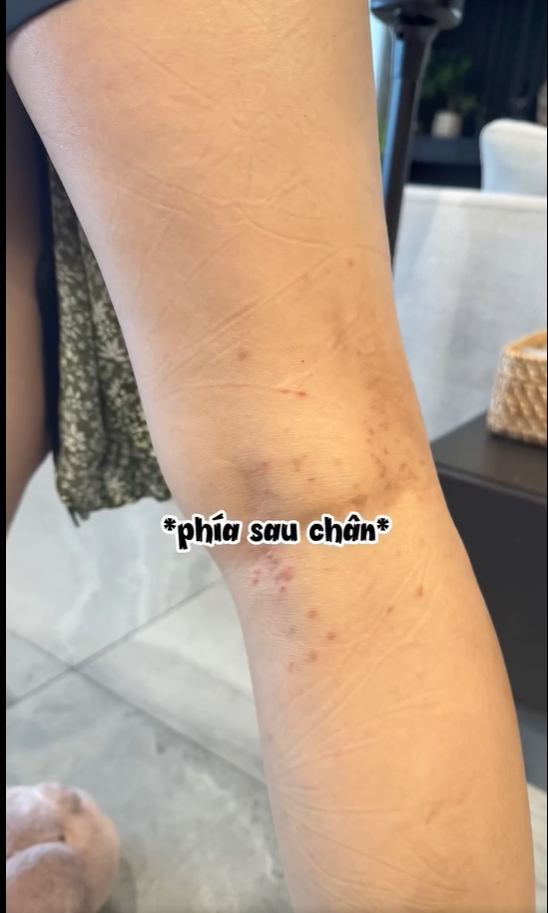 Mẹ bầu Ngô Thanh Vân gặp một tình trạng "vô cùng khó chịu" trong thai kỳ: Ngứa khủng khiếp nhưng vẫn thấy mừng vì 1 điều- Ảnh 4.