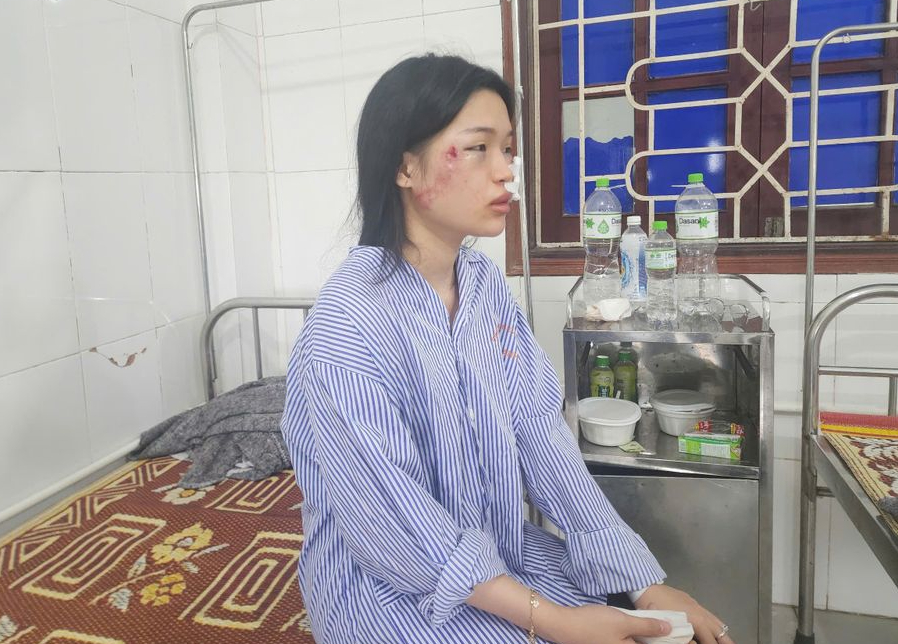 Nạn nhân vụ xe khách lật ở Hà Tĩnh: “Khung cảnh lúc đó rất hỗn loạn và kinh hoàng”- Ảnh 1.