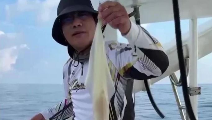 Ăn hải sản suốt 30 năm, đi khám, người đàn ông 64 tuổi sốc nặng trước thông báo của bác sĩ- Ảnh 1.
