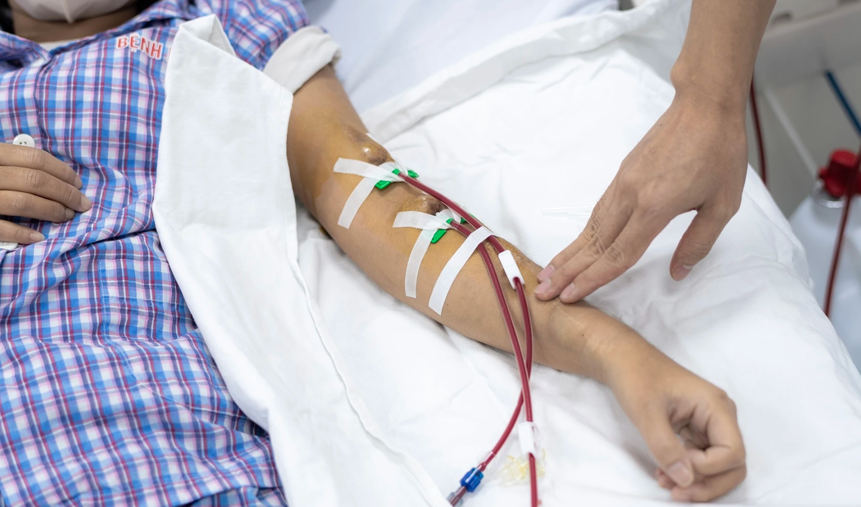 Mới 34 tuổi nhưng đã phải chạy thận hơn 10 năm: Vì 1 sai lầm khiến cơ thể phải 'trả giá đắt'- Ảnh 1.