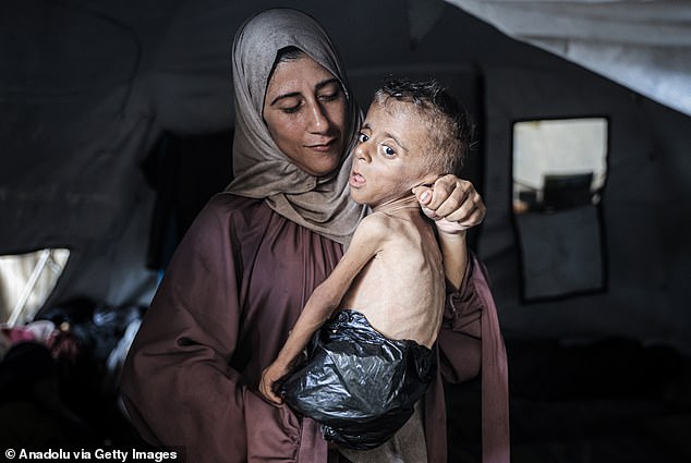 Bức ảnh lột trần sự thật trên Gaza khiến cả thế giới rúng động: Bé trai 18 tháng tuổi chỉ còn da bọc xương, quấn túi nylon thay tã- Ảnh 1.