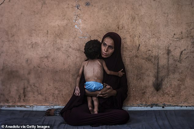 Bức ảnh lột trần sự thật trên Gaza khiến cả thế giới rúng động: Bé trai 18 tháng tuổi chỉ còn da bọc xương, quấn túi nylon thay tã- Ảnh 8.