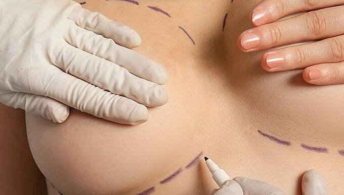 Jun Vũ khoe lưng trần gây sốt, quay lại càng khiến dân tình ngỡ ngàng: Nâng ngực thăng hạng visual, nhiều mỹ nhân sau sinh cũng làm và chưa từng hối hận- Ảnh 11.