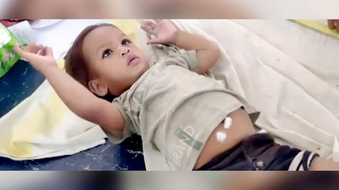 Hy hữu: Em bé hai tuổi cắn chết rắn hổ mang chúa- Ảnh 1.