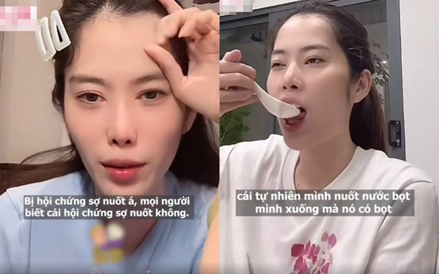 Nam Em mắc hội chứng lạ- Ảnh 1.