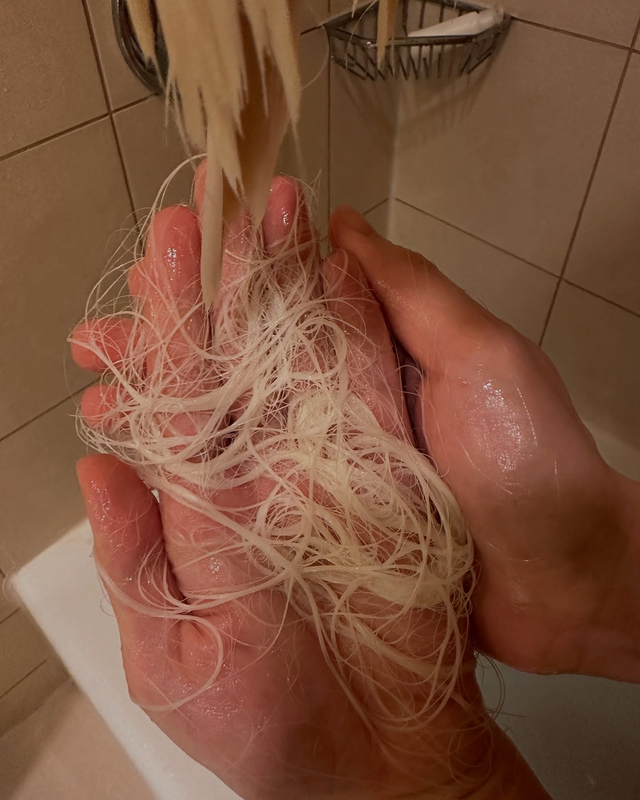 1 tháng sau sự cố kinh hoàng, nữ DJ đăng tâm thư gây sốc về chủ salon tóc và tình hình đáng quan ngại- Ảnh 6.