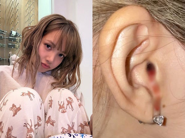 Lisa (BLACKPINK) lên tiếng về bức ảnh chảy máu tai gây hoang mang khắp MXH- Ảnh 1.