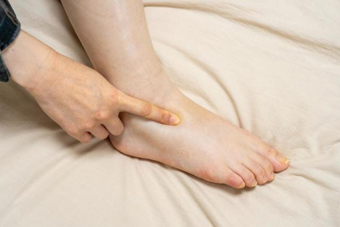 7 dấu hiệu của ung thư bàng quang, rất nhiều người CHƯA TỪNG ĐỂ Ý!- Ảnh 3.