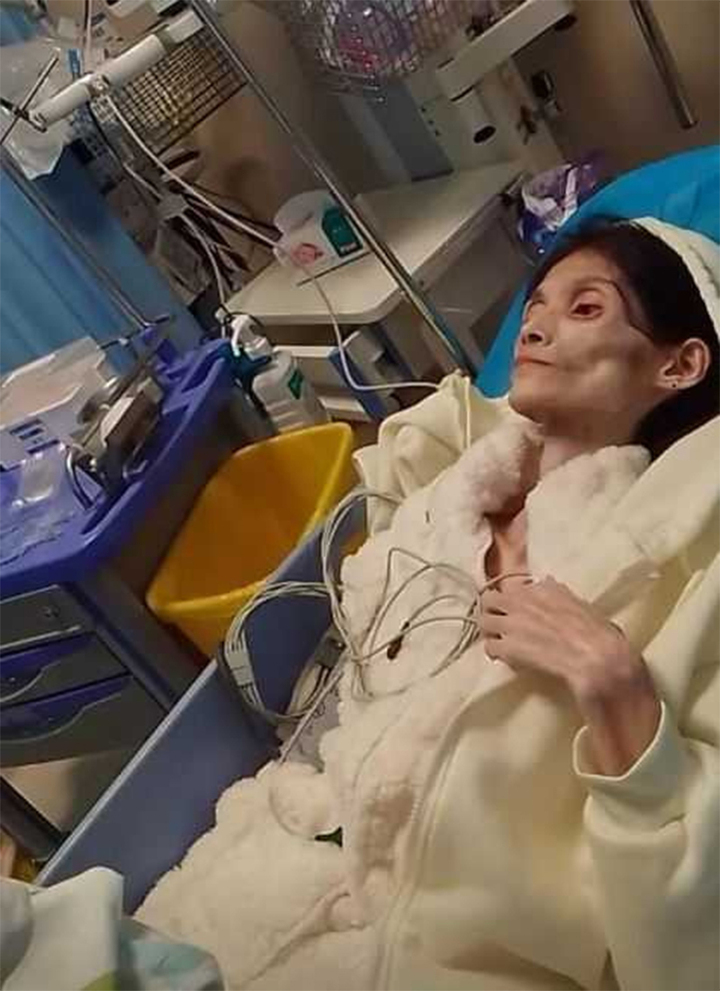 Số phận bi thảm của cô gái xinh đẹp biến thành 'bộ xương di động' 17kg- Ảnh 2.