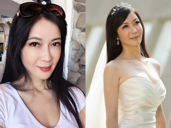 "Nữ hoàng dao kéo" chuyển từ giường bệnh ung thư sang… giường phẫu thuật thẩm mỹ, gây mê suốt 6 tiếng để căng da!- Ảnh 3.