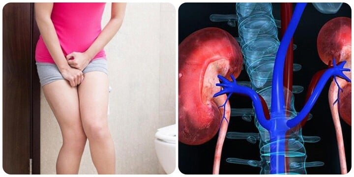 5 dấu hiệu thận đang quá tải và cần đi khám gấp- Ảnh 1.