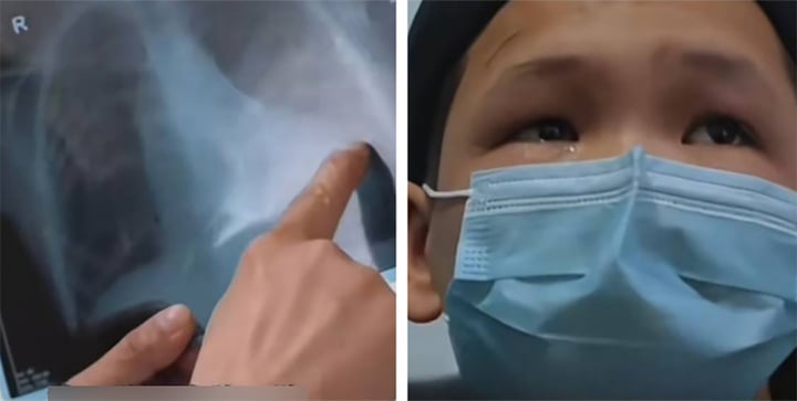 Cậu bé có trái tim biến dạng như một chiếc giày- Ảnh 1.