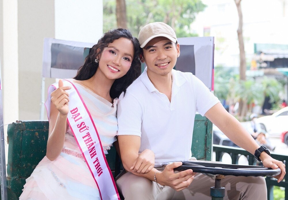 Chồng H'Hen Niê thay đổi thế nào sau cấy tóc trị hói đầu? Phương pháp này có giá bao nhiêu?- Ảnh 4.