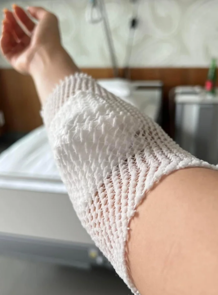 Á hậu Việt mắc bệnh lạ: Có túi nước bẩm sinh trong ổ bụng, 1 năm phải đi hút 2 lần- Ảnh 9.