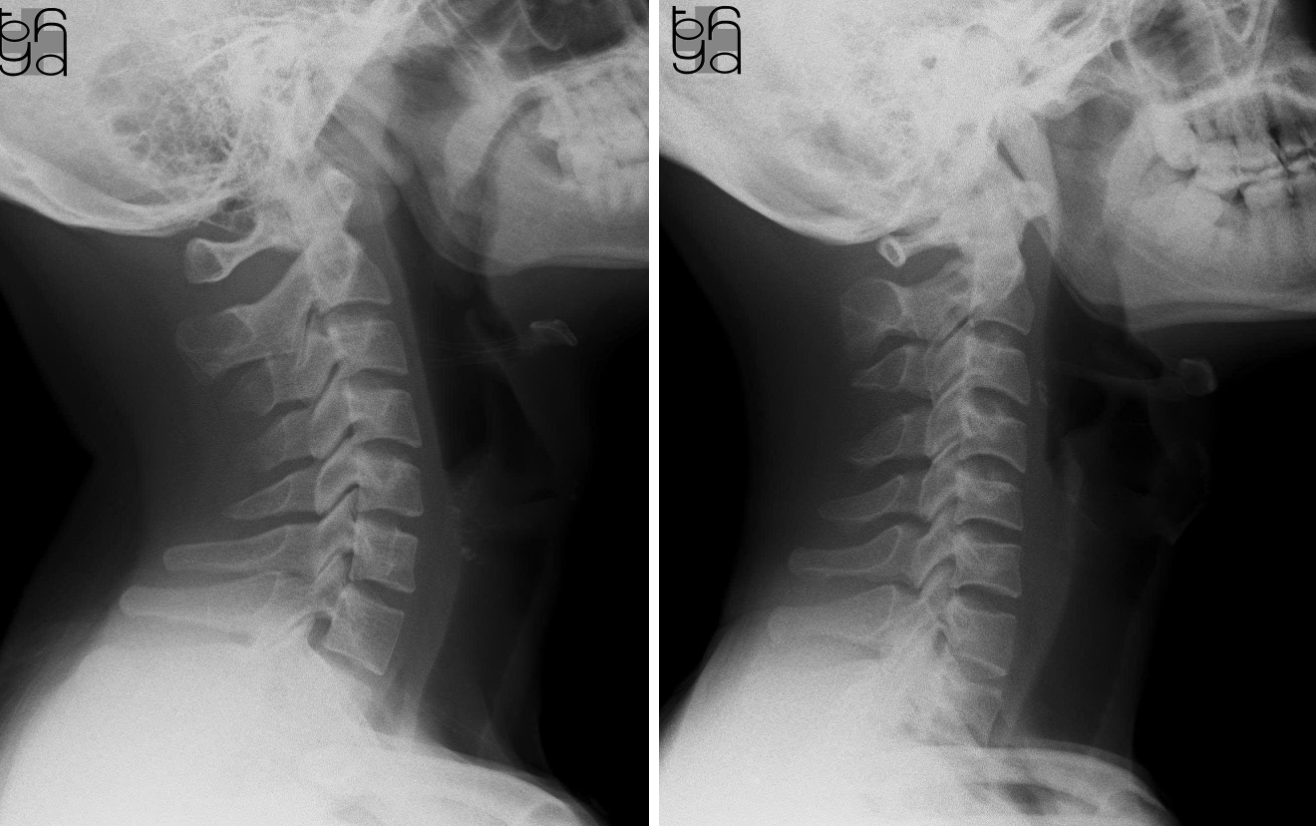 Người trẻ 20 tuổi mà xương khớp như 'người già': Bác sĩ nói đa số đều có 4 đặc điểm, sửa ngay còn kịp- Ảnh 1.