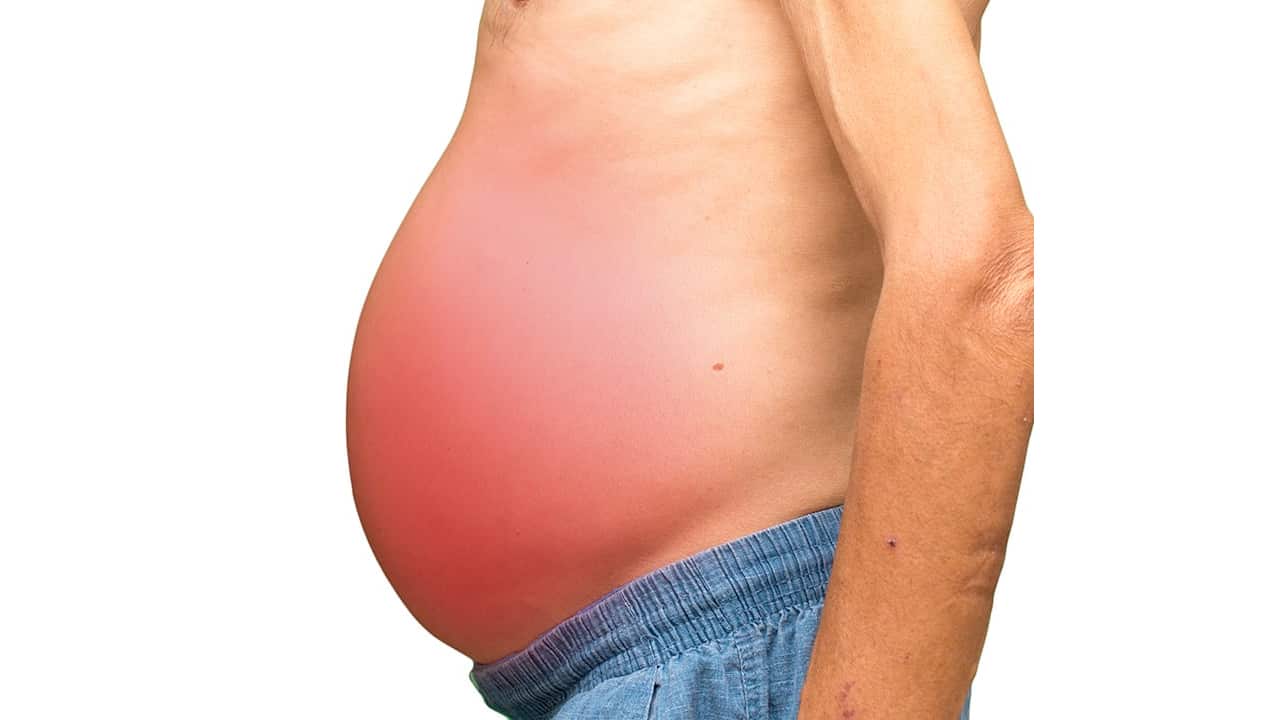 Khi gan suy hỏng nặng, cơ thể sẽ sưng ở 2 chỗ: Có 1 cũng nên đi khám ngay- Ảnh 2. Khi gan suy hỏng nặng, cơ thể sẽ sưng ở 2 chỗ: Có 1 cũng nên đi khám ngay- Ảnh 2.