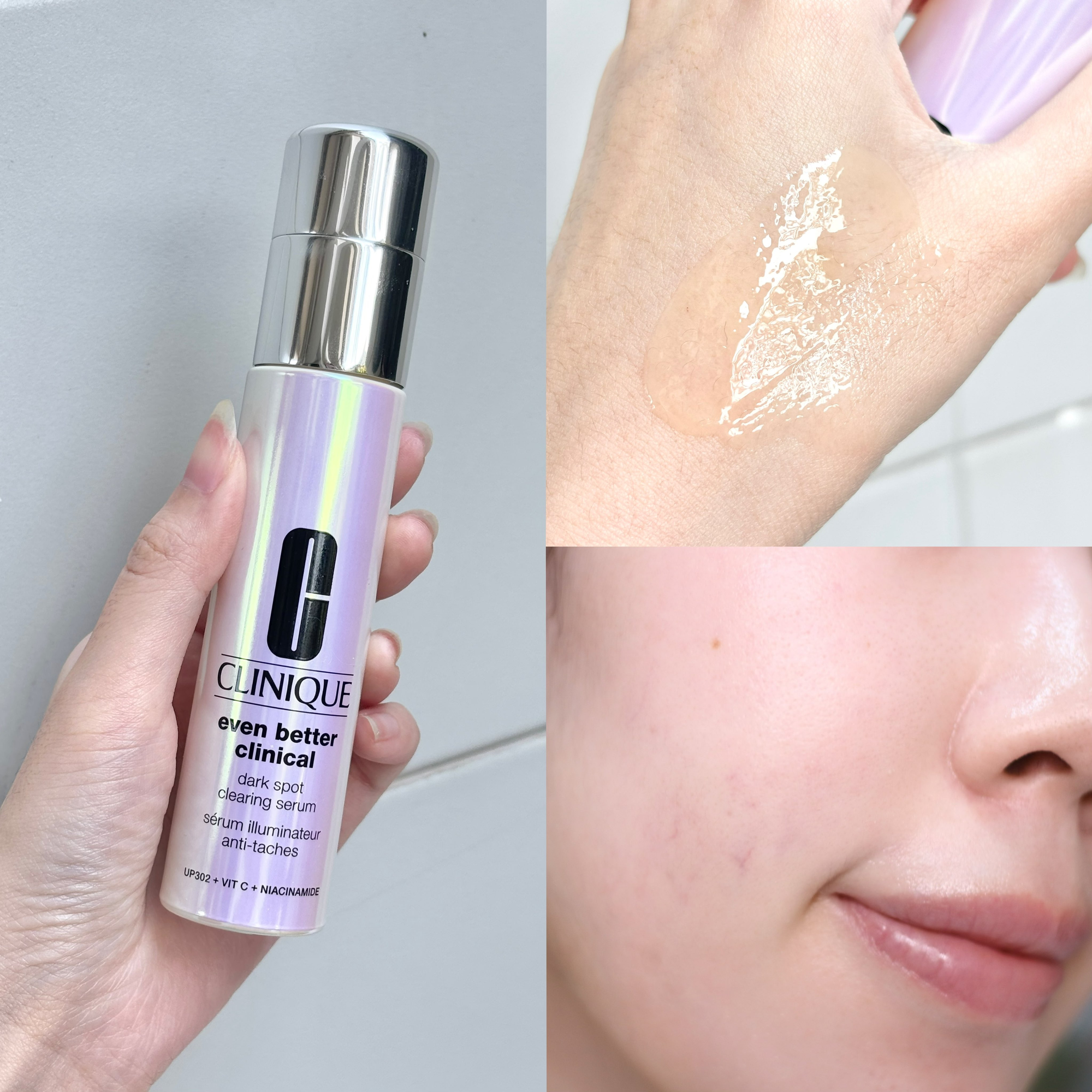 5 serum mờ thâm, giảm nám 