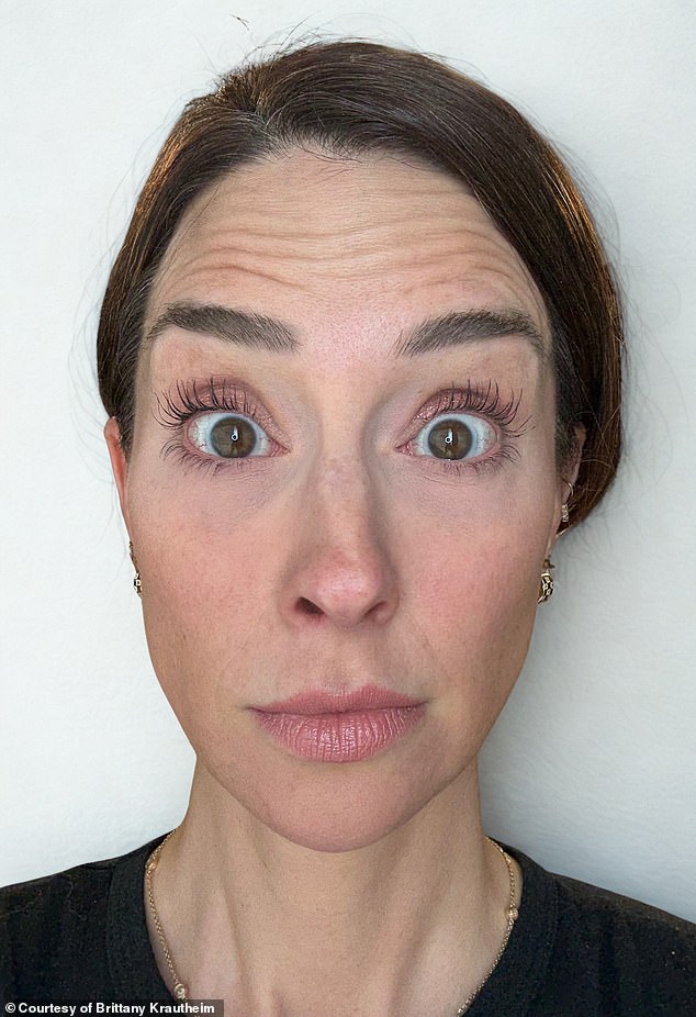 100114387-14885779-anursewhogotbotoxinjectedononlyonesideofherfacetos-a-101751986005622-1752038046451399598496-1752054953200-17520549533851270512870.jpg