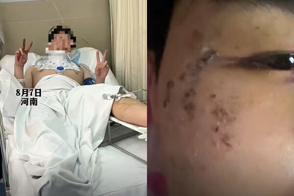 Nằm mơ mình bị rượt đuổi, thanh niên lao từ cửa sổ tầng 3 xuống đất mà không hề hay biết- Ảnh 1.