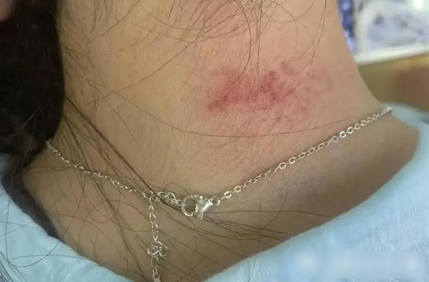 Ph&aacute;t hiện kim loại nặng độc hại vượt mức 1.179 lần cho ph&eacute;p trong loạt trang sức b&aacute;n chạy nhất tr&ecirc;n s&agrave;n thương mại điện tử- Ảnh 1.