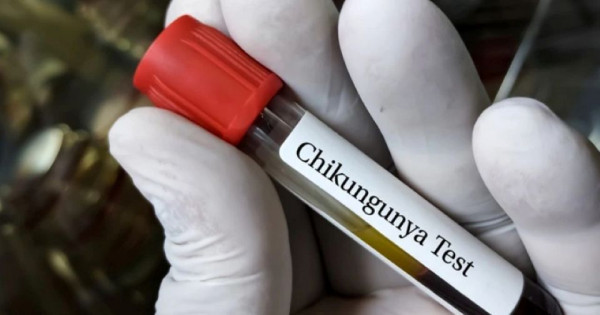 Chikungunya bùng phát ở nhiều nước, Bộ Y tế đưa ra khuyến cáo cho người dân phòng dịch Chikungunya- Ảnh 4.