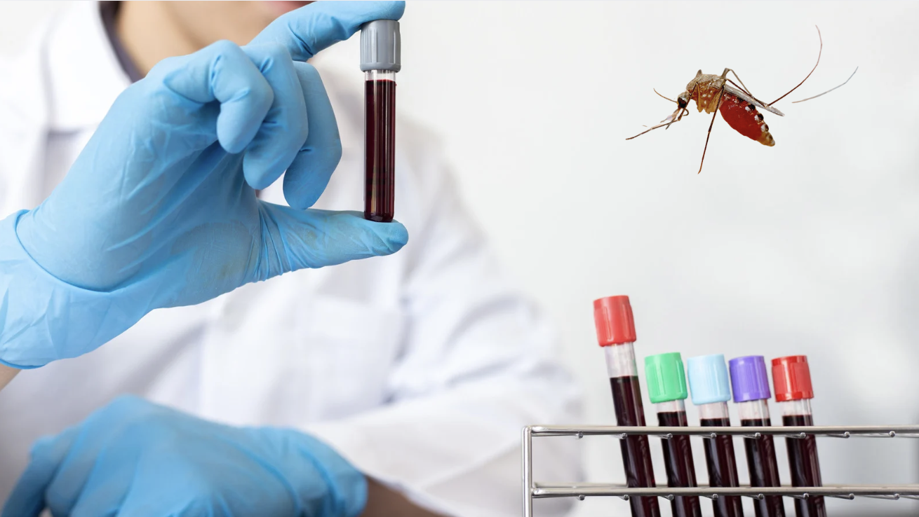 Có nên đi xét nghiệm Chikungunya?- Ảnh 1.