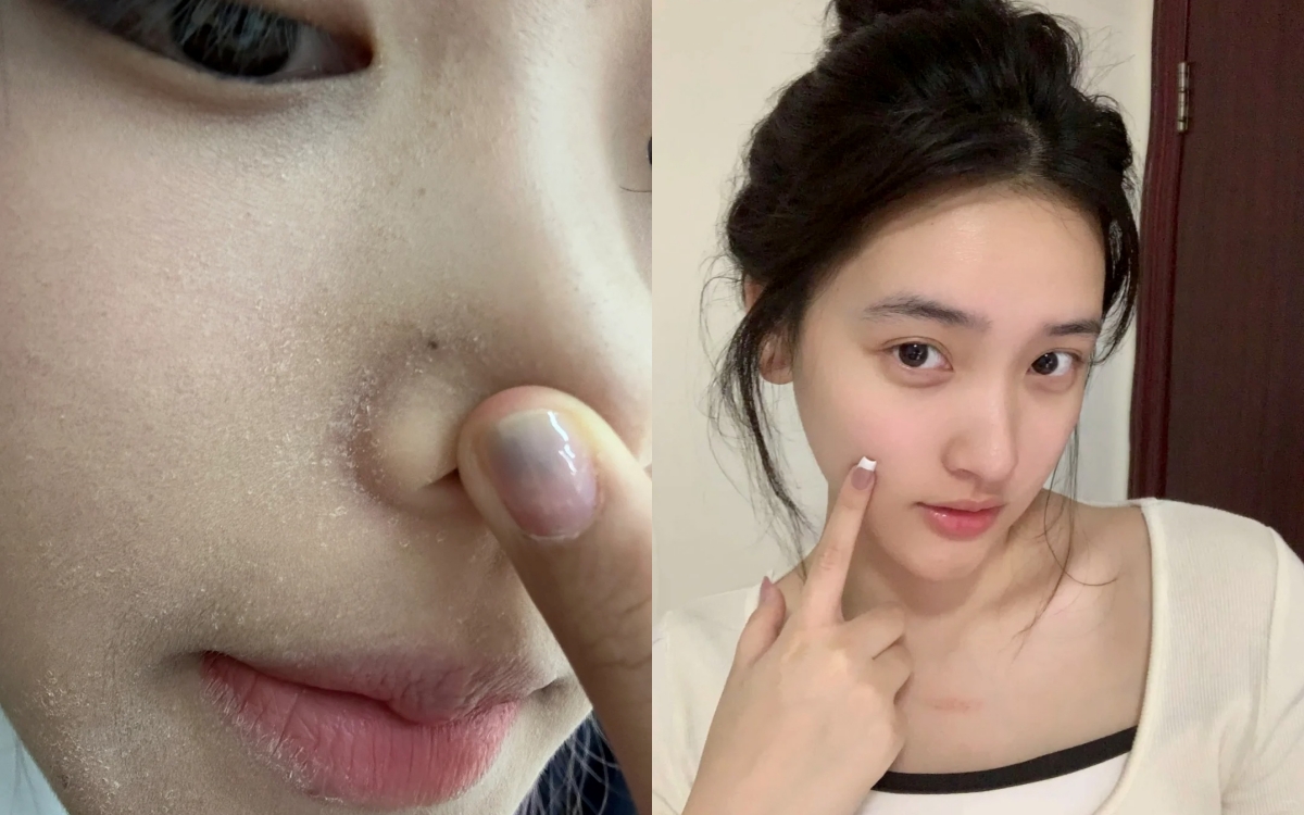 5 serum cấp ẩm cho "da ngậm nước" dù ngồi điều hòa cả ngày- Ảnh 1.