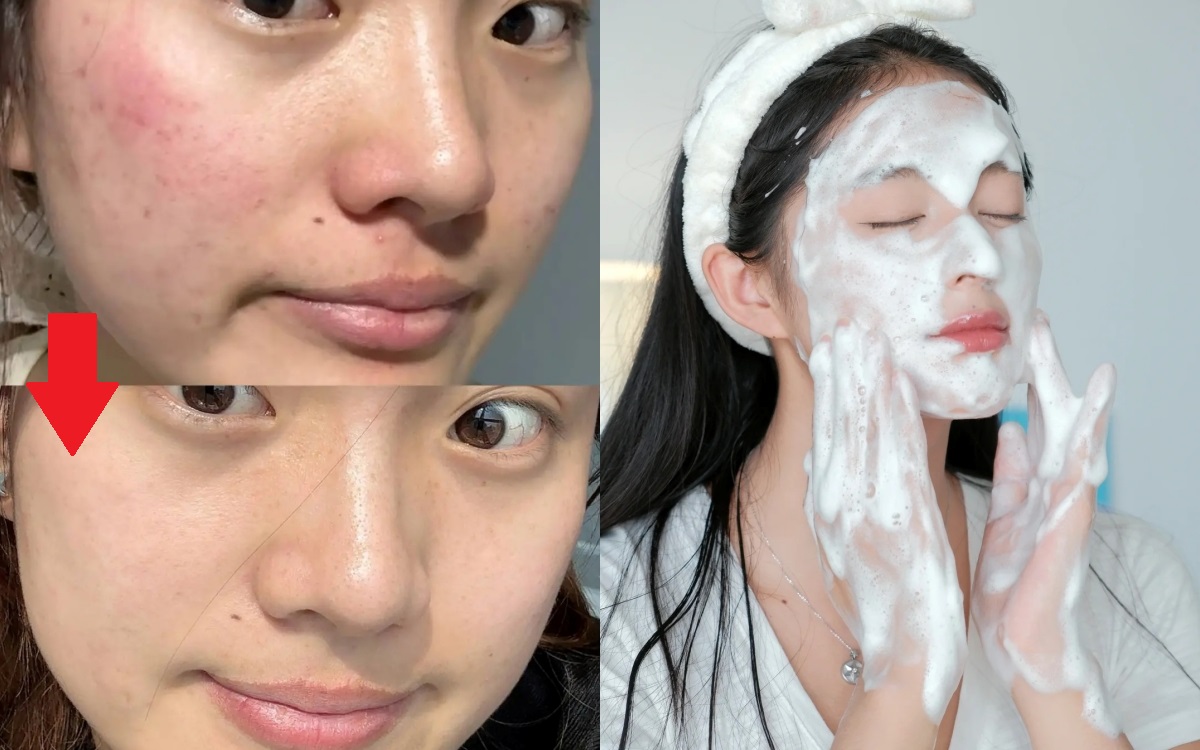 Thay đổi cách rửa mặt, lỗ chân lông của tôi nhỏ hẳn lại và da "đẹp lên trông thấy"- Ảnh 1.