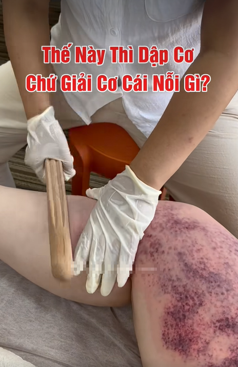 Rùng mình xem clip giải cơ lan truyền MXH, cận cảnh da thịt bị đập bầm tím ai nấy sợ hãi, xót xa- Ảnh 1.