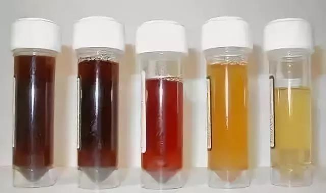 Người đàn ông ngậm ngùi cắt bỏ 1 cơ quan quan trọng dù KHÔNG đau, KHÔNG ngứa, bác sĩ: 90% khối u ở đó là ác tính!- Ảnh 2.