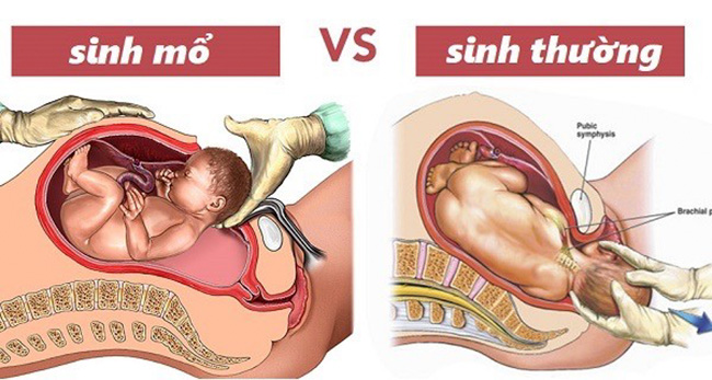 Bệnh viện Nhi Trung ương: Sản phụ mất con vì chọn ngày giờ đẹp để sinh mổ- Ảnh 2.