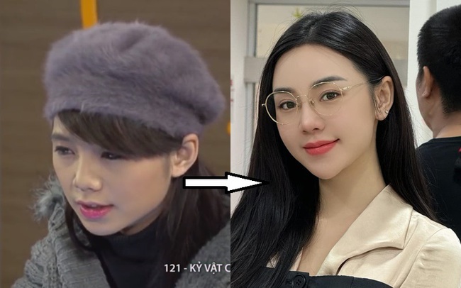 Gương mặt Quỳnh Kool bị làm sao vậy?- Ảnh 5.