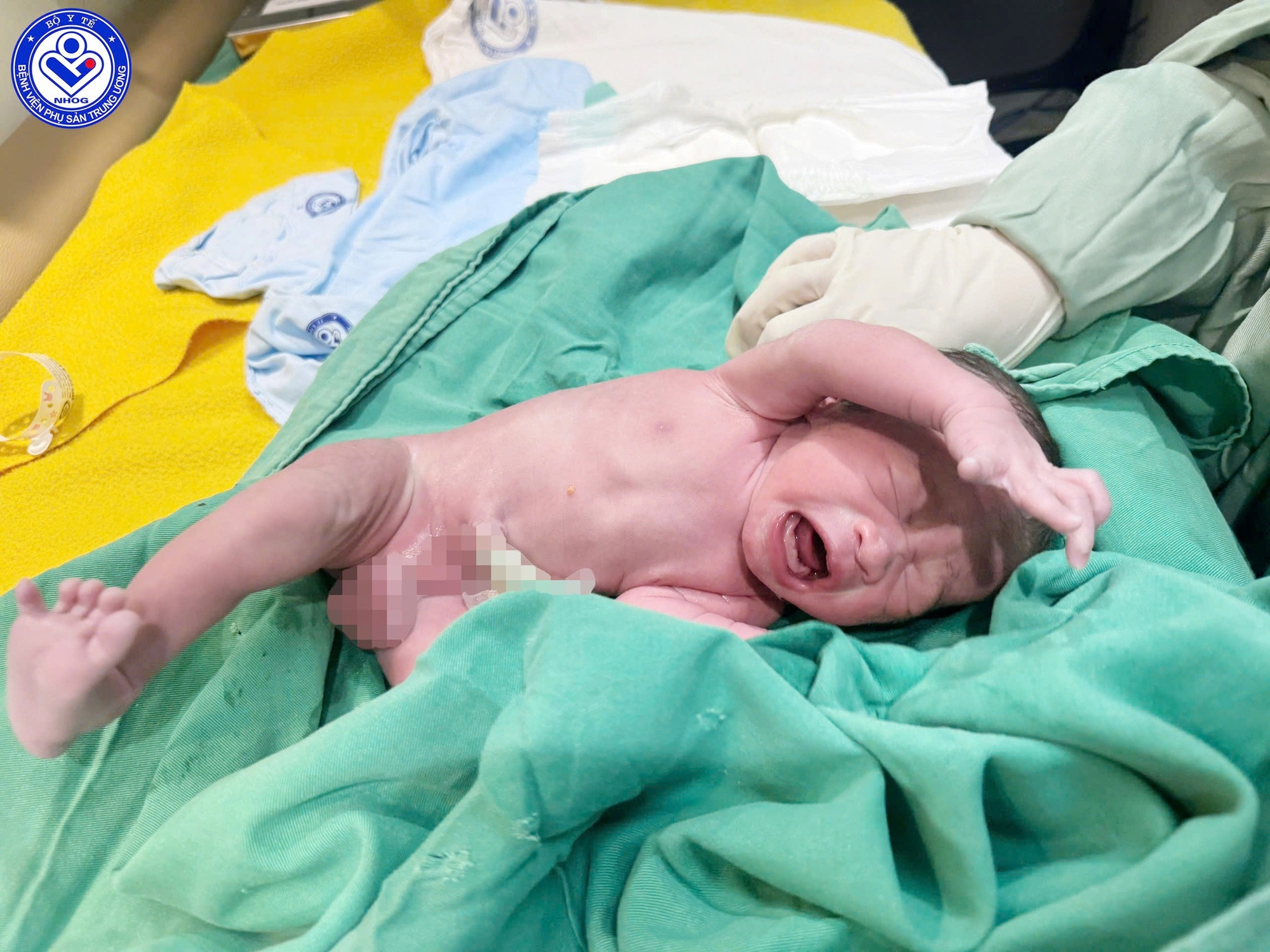 Kỳ tích: Bé trai 1,9 kg chào đời khỏe mạnh từ mẹ mắc ung thư cổ tử cung giai đoạn muộn- Ảnh 2.