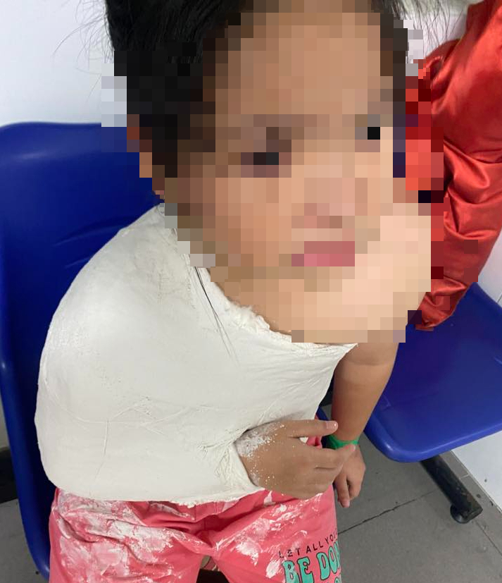 Nhiều trẻ bị gãy tay, chân ở khu vui chơi Nhà văn hóa lao động tỉnh Quảng Ngãi- Ảnh 3.