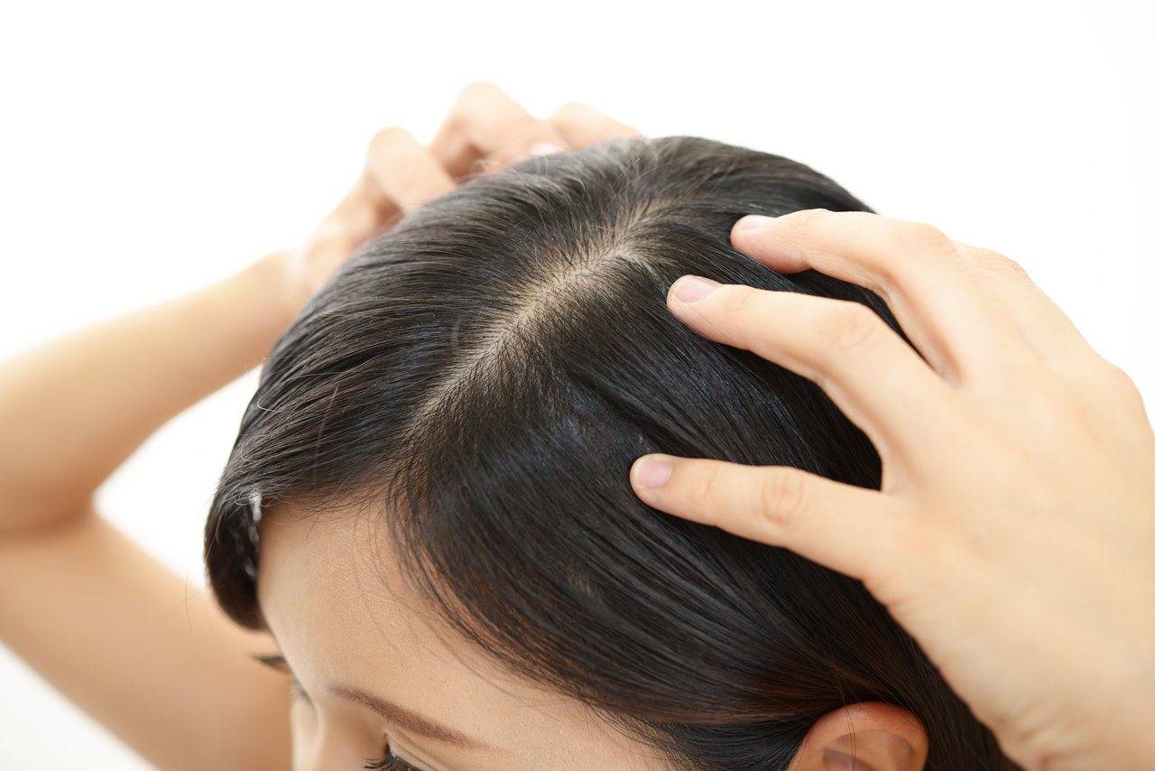 Có cách chữa rụng tóc ở tuổi mãn kinh không? Có 2 lời khuyên cho bạn, gội đầu theo cách này chính là "chìa khóa"- Ảnh 2.